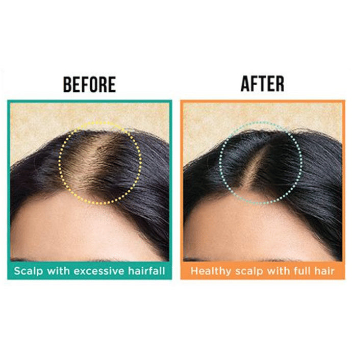 7Herbmaya Natural Hair Growth Oil for Women